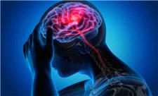 چند شرط برای درمان سکته مغزی