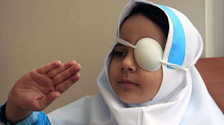 سنجش تنبلی چشم ۲۳ هزار کودک در دزفول