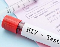 انجام تست HIV، اقدامی حیاتی برای حفظ سلامت فرد و جامعه