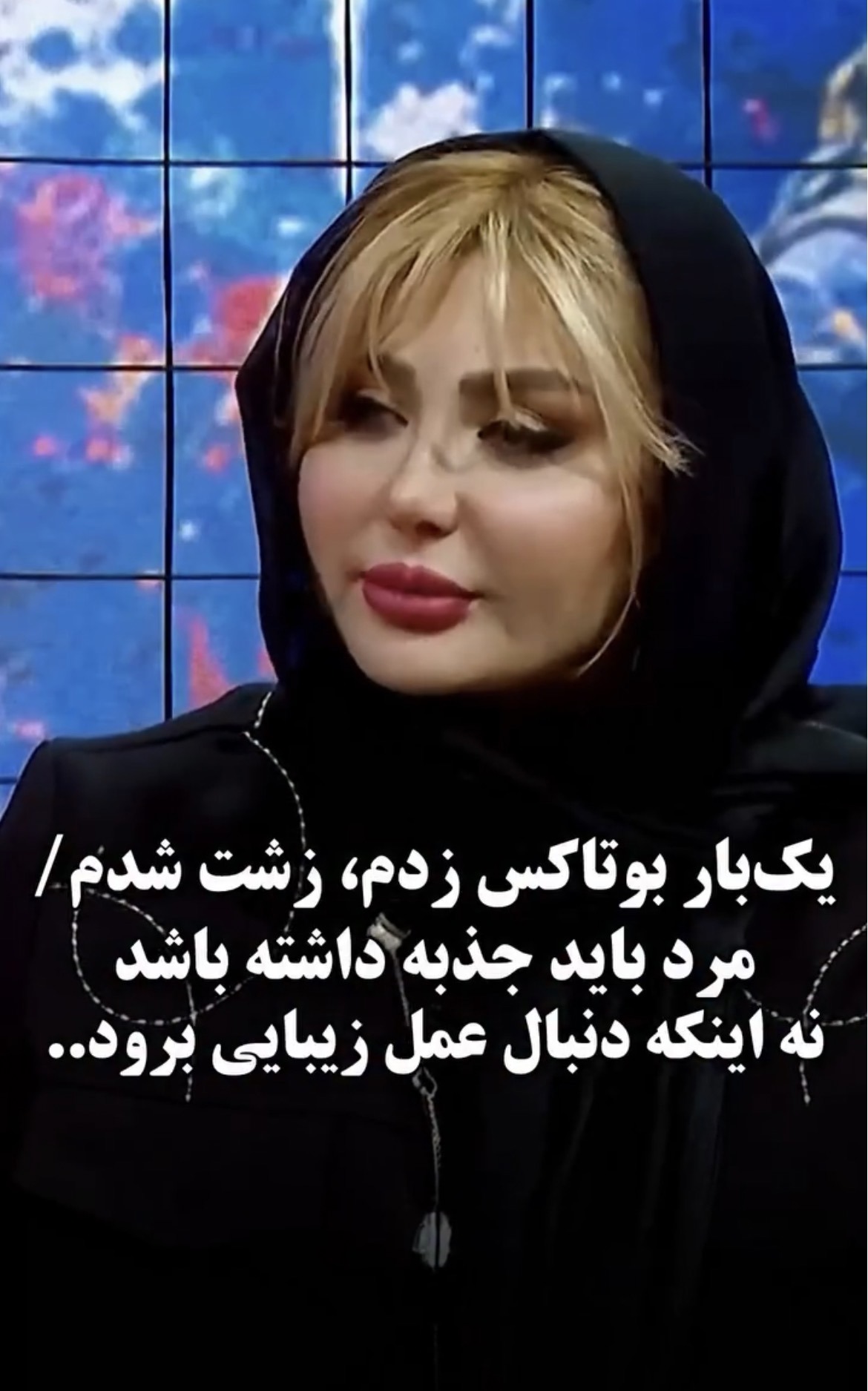 نیوشا ضیغمی : یک بار بوتاکس زدم زشت شدم